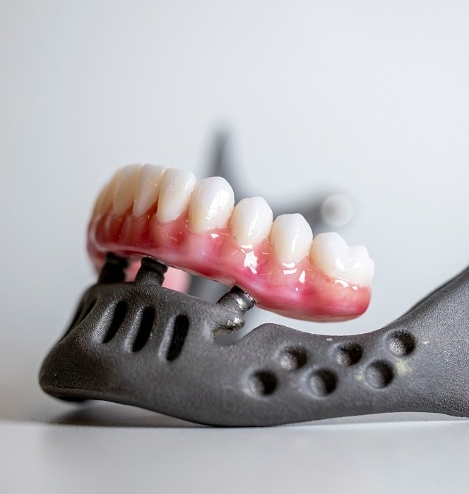 застосування 3D-принтерів у стоматології